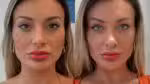 Andressa Urach manifesta insatisfação com a alteração da cor dos olhos