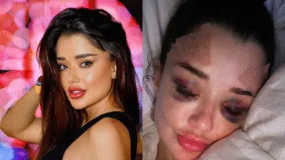 Imagem do post relacionado, leia tambem! Imagem do post relacionado, leia tambem!