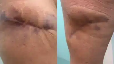 Imagem do post relacionado, leia tambem! Imagem do post relacionado, leia tambem!