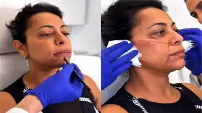 Imagem do post relacionado, leia tambem!