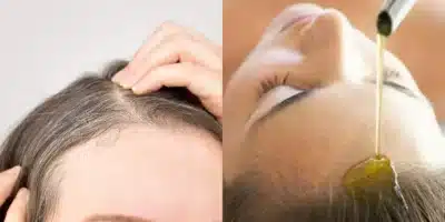 Imagem do post relacionado, leia tambem!