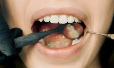 Imagem do post relacionado, leia tambem!