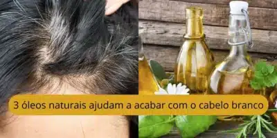 Imagem do post relacionado, leia tambem!