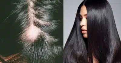 Imagem do post relacionado, leia tambem!