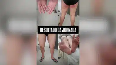 Imagem do post relacionado, leia tambem!
