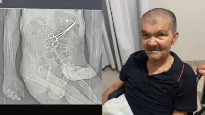 Imagem do post relacionado, leia tambem!