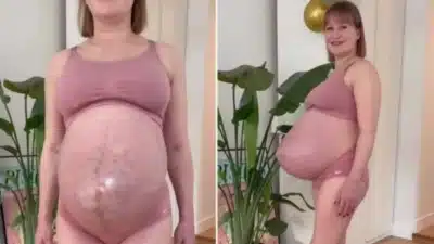 Imagem do post relacionado, leia tambem!