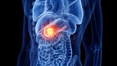 Imagem do post relacionado, leia tambem!