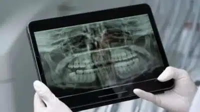 Imagem do post relacionado, leia tambem!