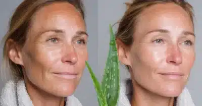 Imagem do post relacionado, leia tambem!