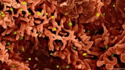 Imagem do post relacionado, leia tambem!