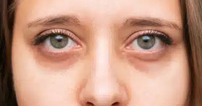 Imagem do post relacionado, leia tambem!