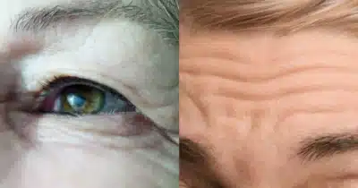 Imagem do post relacionado, leia tambem!