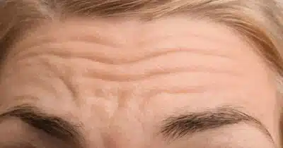 Imagem do post relacionado, leia tambem!