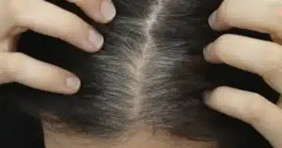 Imagem do post relacionado, leia tambem!