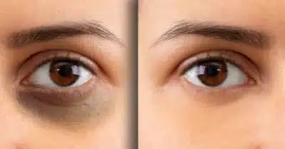 Imagem do post relacionado, leia tambem!