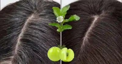 Imagem do post relacionado, leia tambem!