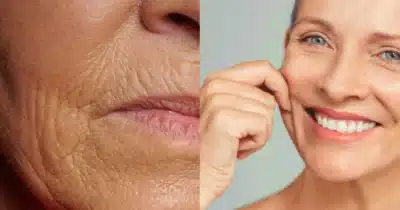 Imagem do post relacionado, leia tambem!