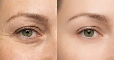 Imagem do post relacionado, leia tambem!