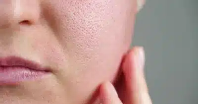 Imagem do post relacionado, leia tambem!