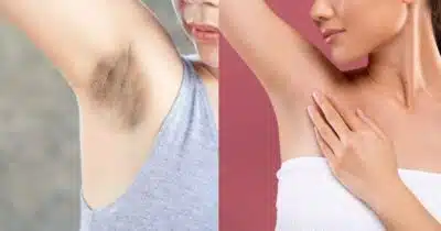 Imagem do post relacionado, leia tambem!