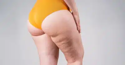 Imagem do post relacionado, leia tambem!