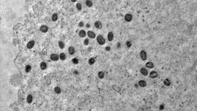 Imagem do post relacionado, leia tambem!