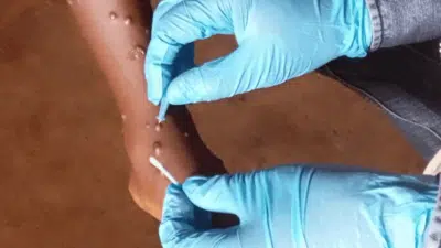 Imagem do post relacionado, leia tambem!